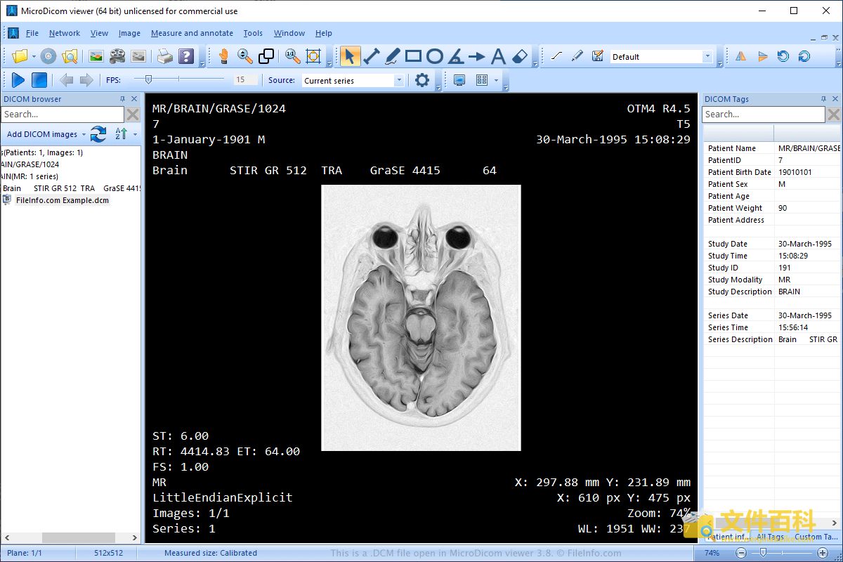 converting an osirix dicom file to windows converting an osirix dicom file to windows